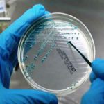 Emergenza polmonite nel Bresciano: è legionella?