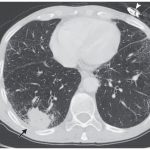 Quando la tua condanna a morte te la porti nel taschino, proprio accanto al cuore...