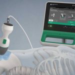 ecografo e Bladder Scanner