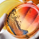 Rischio salmonella: il ministero della salute ritira barrette, croissant e salsicce