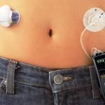 Asp Basilicata, passo finale verso il pancreas artificiale nella terapia del diabete