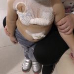 Bimba di 3 anni trapiantata senza più assistenza domiciliare. La mamma chiede aiuto “Il catetere va pulito”