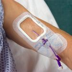 Infezioni legate all’uso del catetere, arrivano le linee di indirizzo per la gestione del paziente oncologico