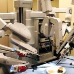 Newcaslte, non sapeva usare il robot e il paziente perse la vita: chirurgo a processo