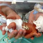Oggi si celebra la giornata mondiale del neonato prematuro