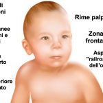 Ogni anno in Italia nascono 25.000 bimbi affetti da sindrome alcolica fetale