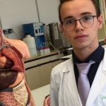 Giuseppe Bungaro, giovane talento della medicina:”Ho 18 anni e aiuto i cardiochirurghi con lo stent salva-vita da me progettato”