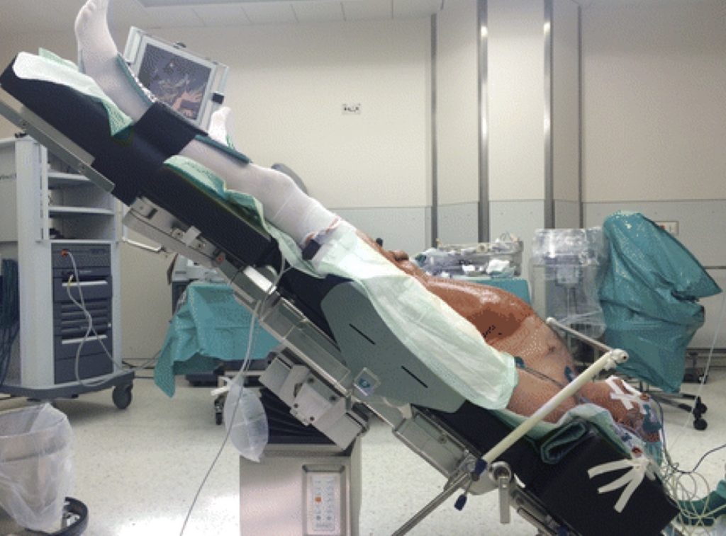 Posizione di Trendelenburg nel trattamento del paziente in stato di