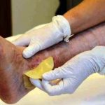 Usl Piacenza, presentato “L’Osservatorio aziendale lesioni cutanee”