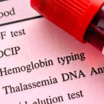 Beta talassemia, l’efficacia della terapia genica dimostrata da un trial clinico