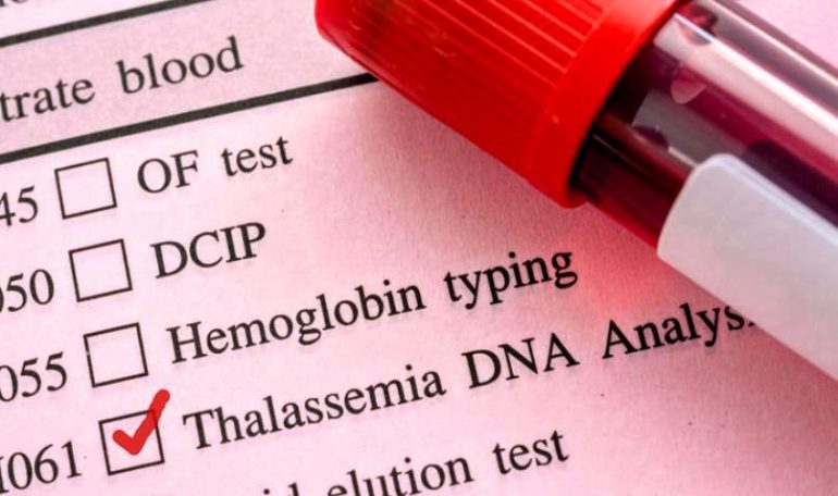 Beta talassemia, l’efficacia della terapia genica dimostrata da un trial clinico