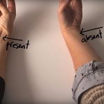 Dal muscolo palmare lungo al tubercolo di Darwin: sono almeno 9 i relitti evolutivi nel corpo umano