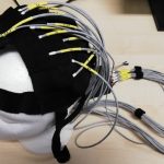 Sla, arriva il caschetto che “sblocca” la comunicazione 1