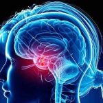 Morbo di Cushing e acromegalia, l’Aifa premia due progetti di nuove cure