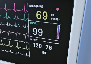 Cardiologia Cardarelli, tutti i monitor cardiaci silenziati con una graffferta: indaga la Magistratura