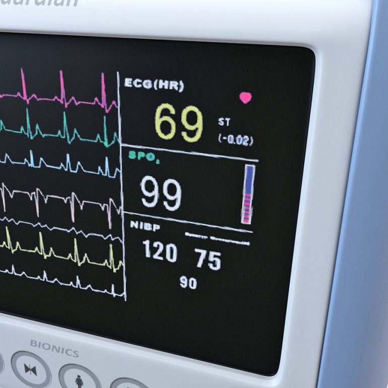 Cardiologia Cardarelli, tutti i monitor cardiaci silenziati con una graffferta: indaga la Magistratura