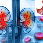 Inibitori pompa protonica danneggiano i reni