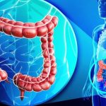 Tumore del colon-retto, individuato un gene responsabile