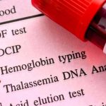 Beta-talassemia, nuove opportunità di cura dalla terapia genica