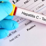 Epatite C in Italia: l'eradicazione come obiettivo perseguibile 2