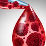 Mieloma multiplo: parere positivo del Chmp per due triplette di farmaci