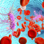 "Sepsi: emergenza da affrontare a livello multidisciplinare"