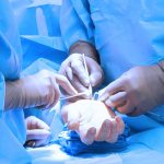 Pordenone: primo innesto osseo ad una mano da donatore cadavere