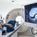 TAC con radiazioni dimezzate: per AIFM è una “non scoperta”