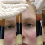 I farmaci antiretrovirali