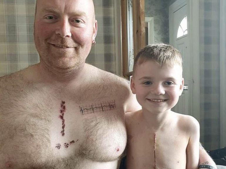 Padre si tatua finta cicatrice