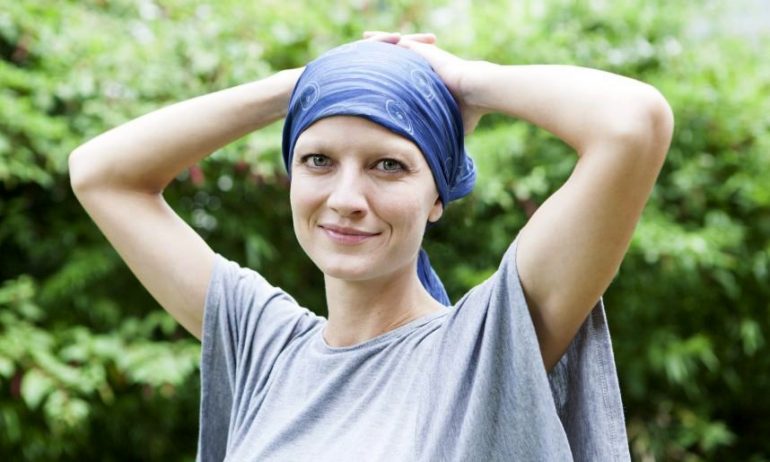 Alopecia permanente da chemioterapici: si studiano cause e possibili cure