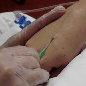 Incannula arteria anziché vena: richiesti € 30.000 di risarcimento ad infermiera perugina per il dolore provocato 2