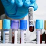 Leucemie, la ricerca fa enormi progressi