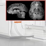 L’immagine più definita di sempre del cervello umano grazie ad una risonanza magnetica durata 100 ore