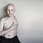 Scott, il bambino diventato angelo a causa di un osteosarcoma. Nascose la malattia alla mamma per non farla preoccupare