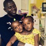 Gemelle siamesi destinate a morire, il padre:”Non sceglierò io chi salvare”