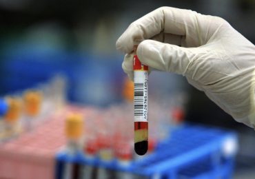 Institute for Biology of Aging:“La presenza di 14 biomarcatori nel sangue preannuncia la morte entro 10 anni”