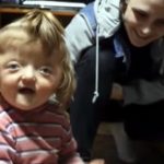 Bimba affetta da craniosinostosi rifiutata dall’asilo:“Potrebbe spaventare i compagni di classe” 1