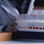 Bozza automatica 141