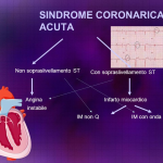 Sindrome Coronarica Acuta (S.C.A.) e terapia: dibattito Ticagrelor vs Prasugrel
