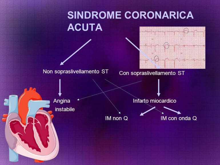 Sindrome Coronarica Acuta (S.C.A.) e terapia: dibattito Ticagrelor vs Prasugrel