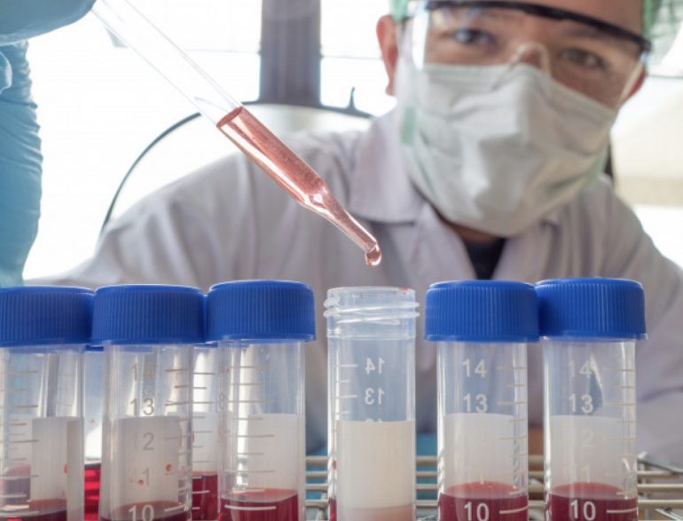 Un test del DNA brevettato in Italia per scovare nel sangue i primi segni di un tumore