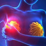 Bozza automatica 262