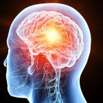 Bozza automatica 336