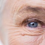 Maculopatia senile umida: nuove terapie per proteggere la retina