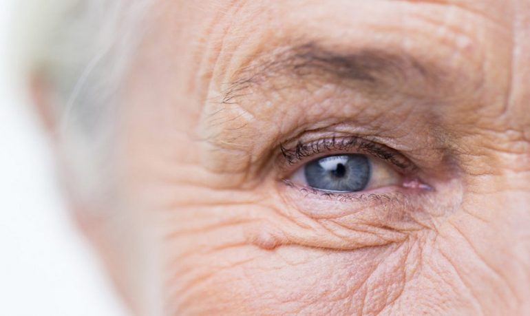 Maculopatia senile umida: nuove terapie per proteggere la retina