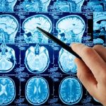 Malattie neurologiche, a Bari la riunione annuale della Sin appulo-lucana