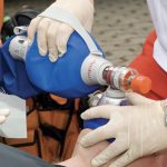 Ventilazioni con maschera facciale e pallone autoespandibile: meglio la tecnica ad una o due mani? 2