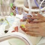 Francia, il mistero della malformazione "sans bras” che colpisce i bambini