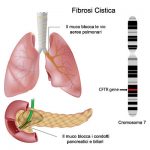 Nuovo trattamento fibrosi cistica: bene triplice terapia elexacaftor/tezacaftor/ivacaftor